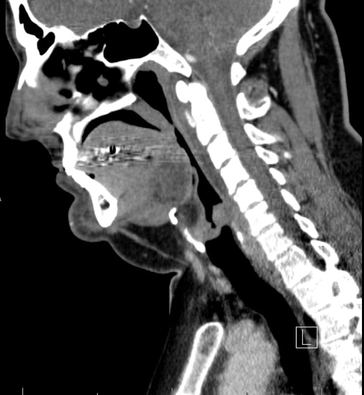 The Ultimate Radiology Quiz: Trivia | Attempts: 297 - Trivia & Questions